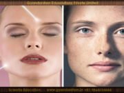 How does sunburn damage the skin