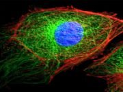 Questions with answers on “Cytoskeleton and Its Role in Cell Structure” Role of cytoskeleton in cell dynamics