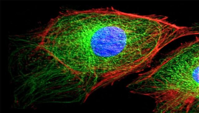 Role of cytoskeleton in cell dynamics