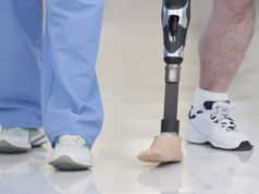 India’s Leap in Affordable Prosthetics: ADIDOC Carbon Foot Unveiled at AIIMS Bibinagar Sets New Global Standards ADIDOC Carbon Foot Unveiled at AIIMS