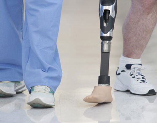 India’s Leap in Affordable Prosthetics: ADIDOC Carbon Foot Unveiled at AIIMS Bibinagar Sets New Global Standards ADIDOC Carbon Foot Unveiled at AIIMS